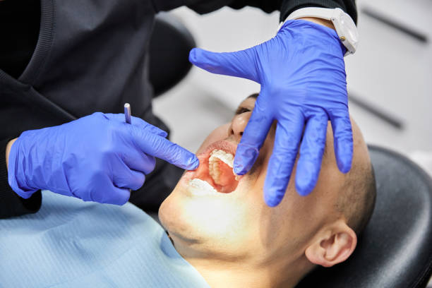 Best Broken or Cracked Tooth Emergency Dentist in Spring Valley, IL